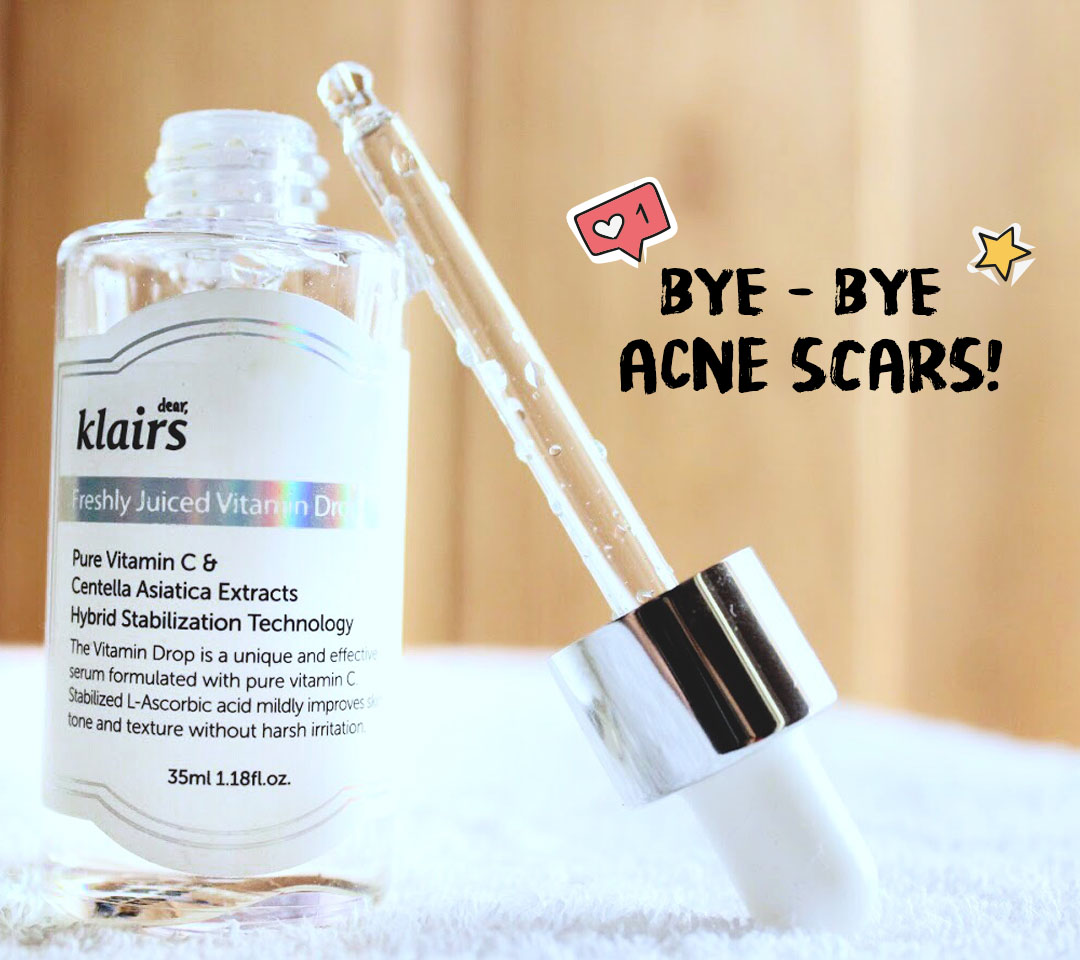 5 Acne Skin Saviors! 5 Acne Skin Saviors! Favful
