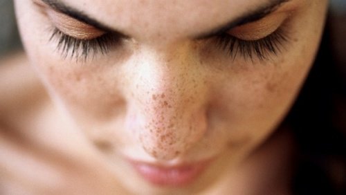 3 Key Things To Know When Dealing With Dark Spots 3 Key Things To Know When Dealing With Dark Spots Favful